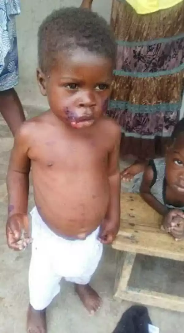 See What A Heartless Father Did To His 3-Year-Old Child For Defecating In The Bedroom (Photos)